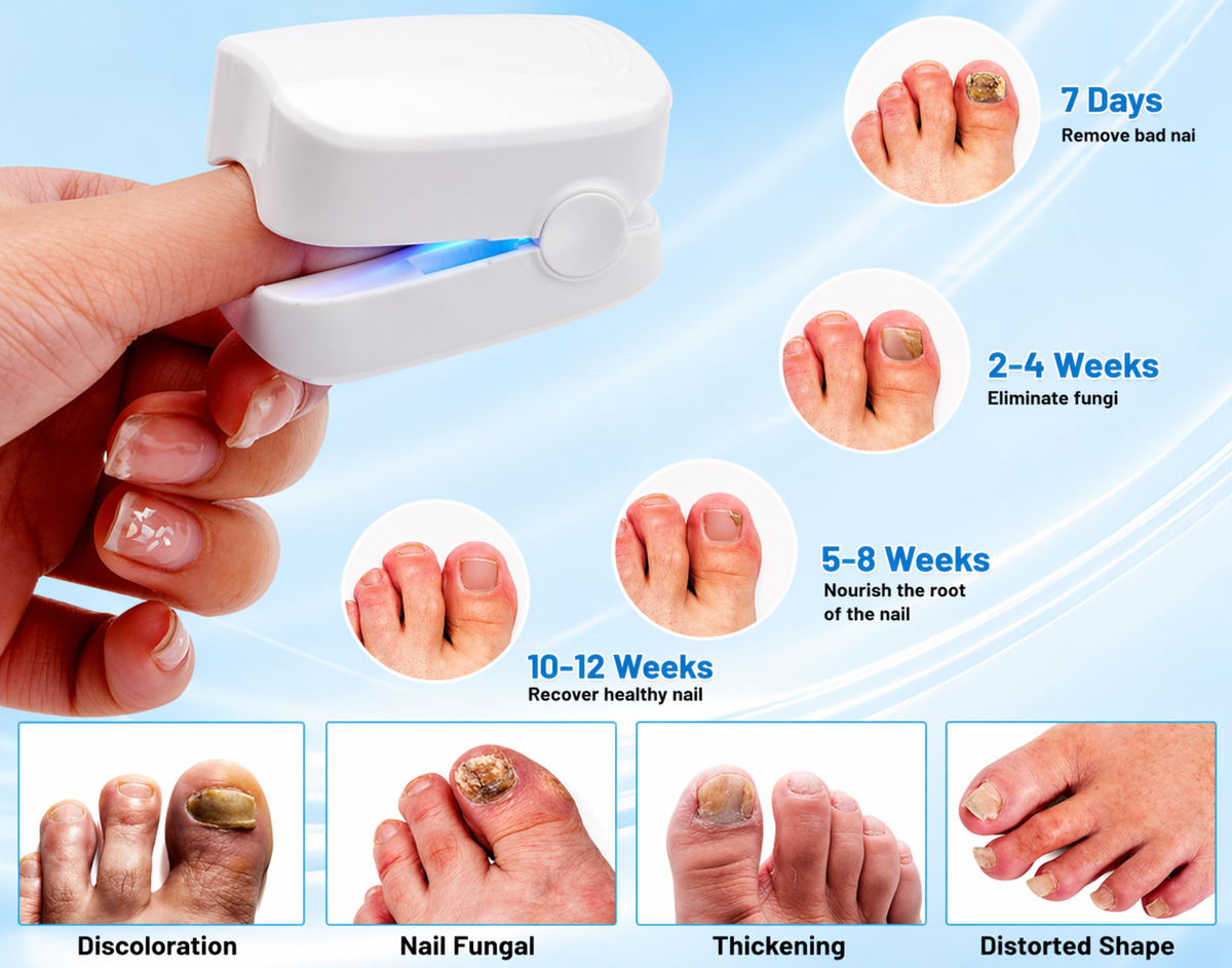 SAY GOODBYE TO NAIL FUNGUS WITHOUT PAIN, CREAMS OR MEDICATIONS